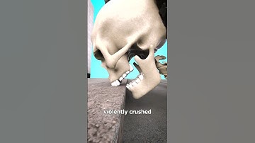 How Curb Stomping Works 😨