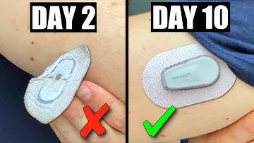 7 Tips to Make Dexcom G6 Sensor Stick｜Never Falls Off｜10 Days Guaranteed