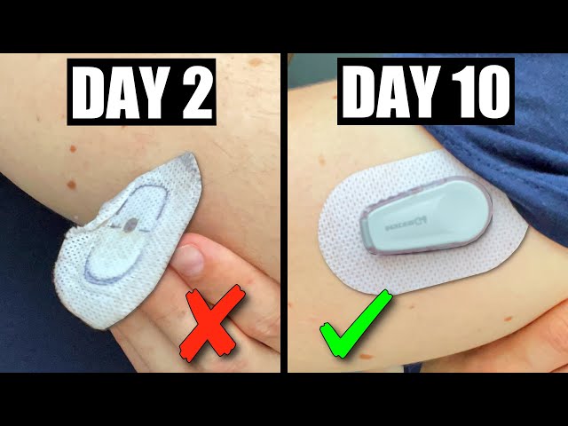 Dexcom G6 sensors not sticking to skin? : r/Type1Diabetes