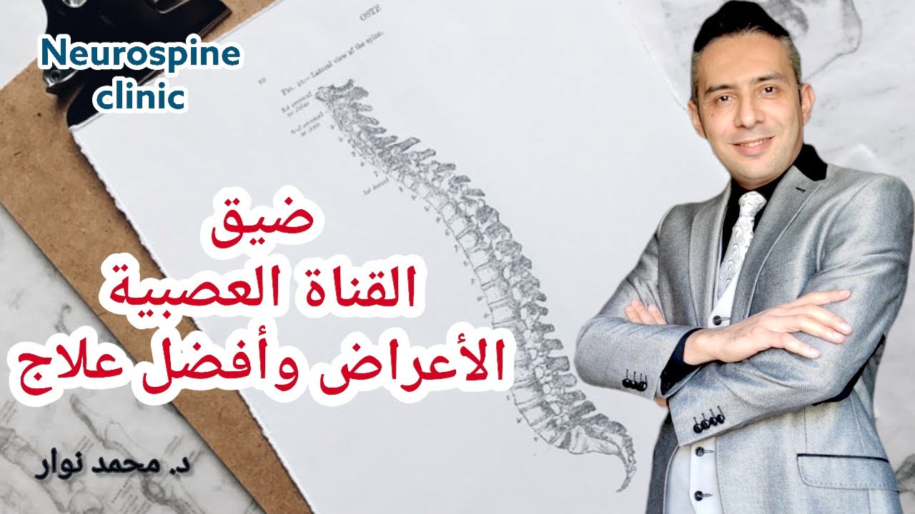 ضيق القناه العصبية الأعراض وأفضل علاج