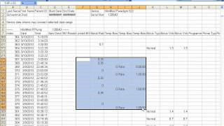 Locating Temp Basal with Excel log.-2.avi