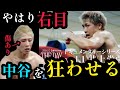井上尚弥の右目に傷？！そして井上尚弥の常人には理解できない考え方