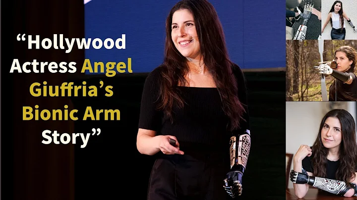 Power of Superhuman Strength| Bionic Arm| Angel Giuffria| Motivational| Urdu/Hindi