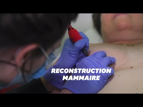 Vidéo: Mamelons En Forme De Cœur: Chirurgie Ou Tatouage