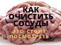 Продлить жизнь. Чистка лечение сосудов головного мозга и шеи