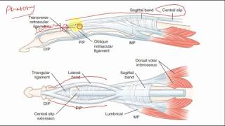 Why swan neck deformity in Rheumatoid arthritis?