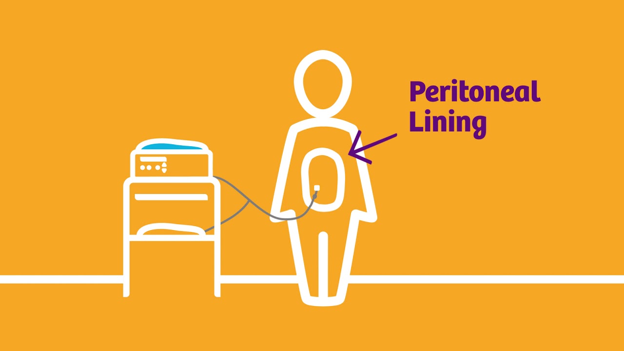 peritoneal-dialysis-process-youtube