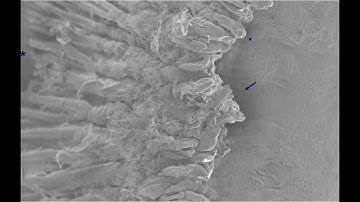 Cyclophotocoagulation Part I: Trans-scleral Cyclophotocoagulation (Malik Y. Kahook, MD)
