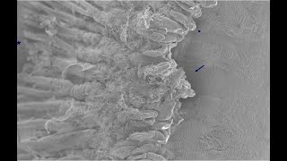 Cyclophotocoagulation Part I: Trans-scleral Cyclophotocoagulation (Malik Y. Kahook, MD)