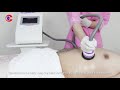 How to Slim Tummy by 54D1 5IN1 Ultrasonic Cavitation Machine