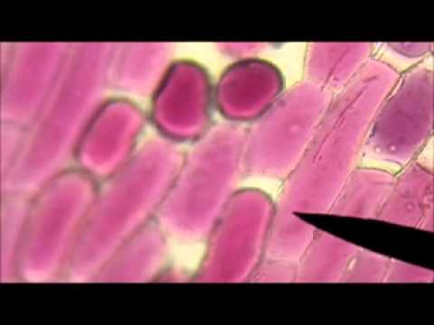 วีดีโอ: Plasmolysis ส่งผลต่อเซลล์พืชอย่างไร?