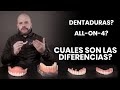 Dentaduras vs Sobre Dentaduras vs All-on-4 Implantes Dentales