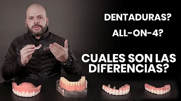 ¿Cuántos dientes debe tener una dentadura superior?