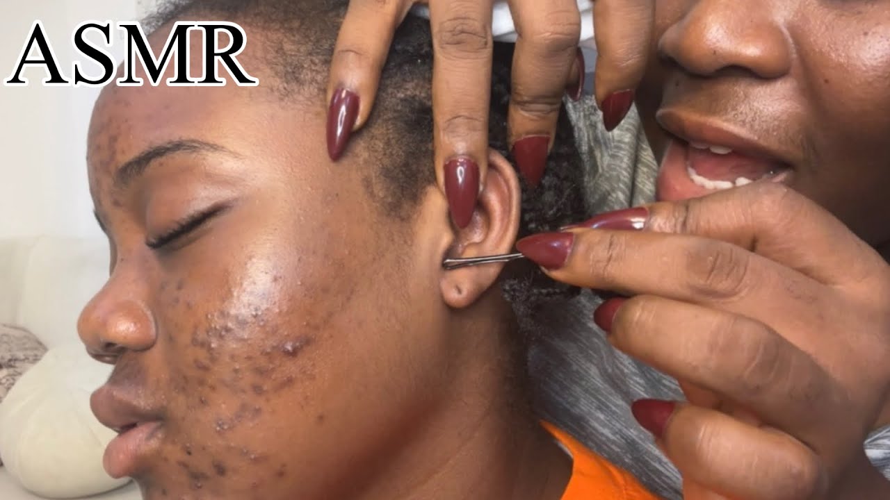 ASMR✨Face Pimple pop, Bobby pin, Tooth-pick, Dental floss and Deep Ear Cleaning