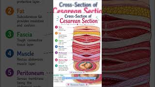 🩺 Cross-Section of Cesarean Section (C-Section) | Anatomy Made Simple 🤰#nursing #anatomy #tips