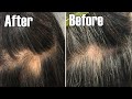 White Hair To Black Hair Mixture It Turns Gray Hair Back To Its Natural Color! Only 2 Ingredient