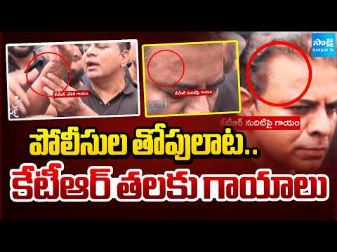 పోలీసుల తోపులాట.. కేటీఆర్ తలకు గాయాలు | High Tension At Assembly | KTR Injured | Sakshi Tv - SAKSHITV