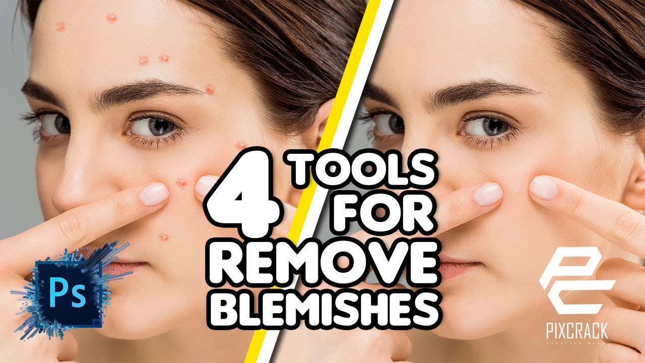 How to remove blemishes | photoshop tutorial | remove pimple | remove dark spot