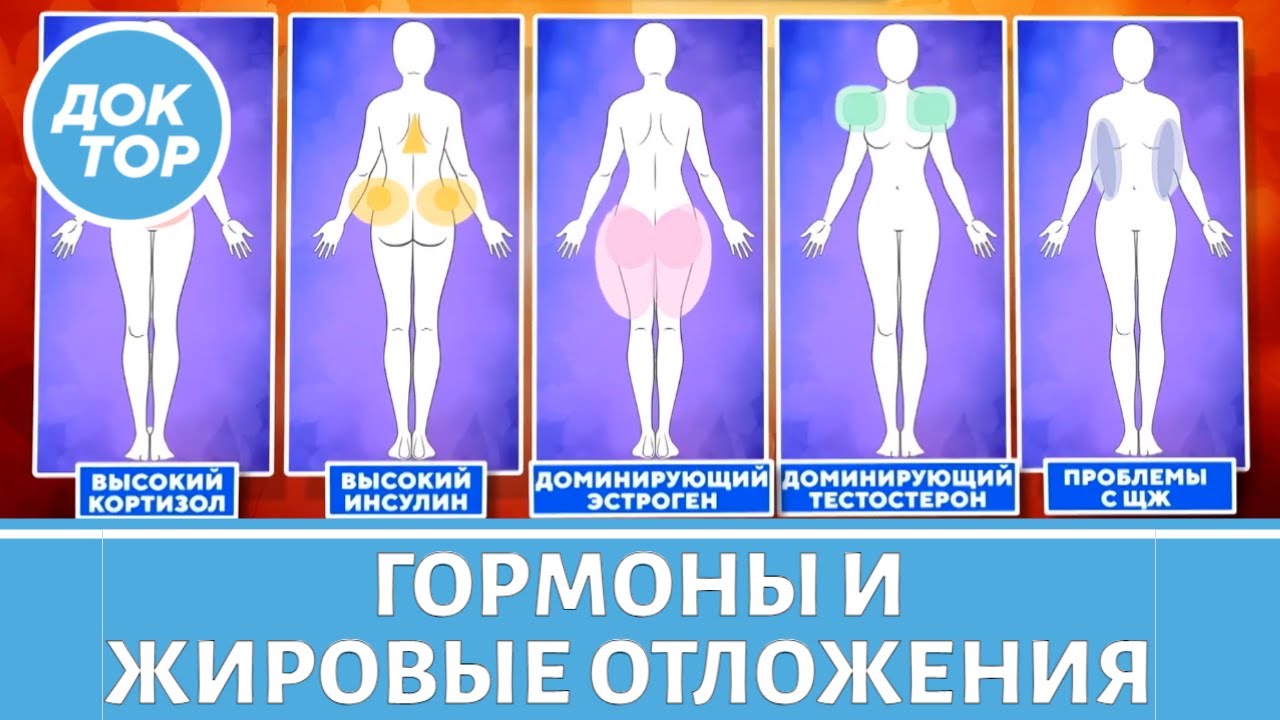 Локальные жировые отложения = проблемы с гормонами?