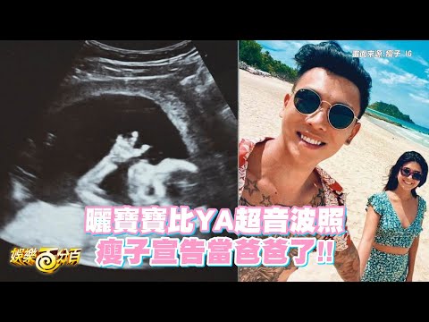 曬寶寶比YA超音波照 瘦子宣告當爸爸了!!