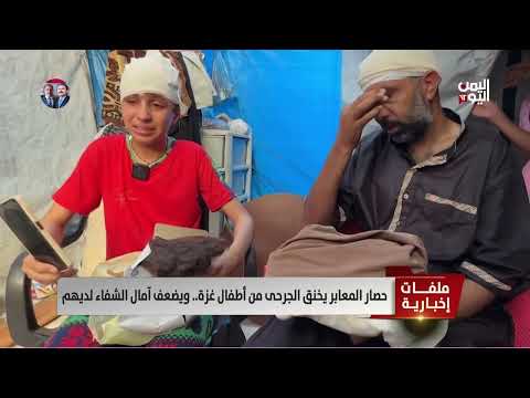 غزة: طفلة تتصارع مع إصابتها بعد قصف إسرائيلي