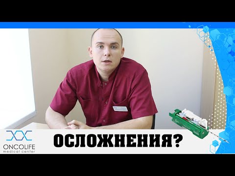 Осложнения после проведения трепанобиопсии