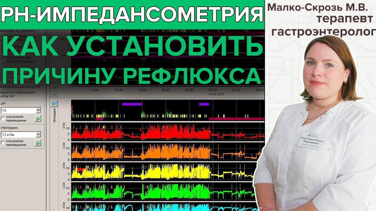 Импедансометрия пищевода. Импеданс РН-метрия суточная что это. Импедансная PH метрия. Суточная импеданс-PH-метрия пищевода. Внутрипищеводная импедансометрия.