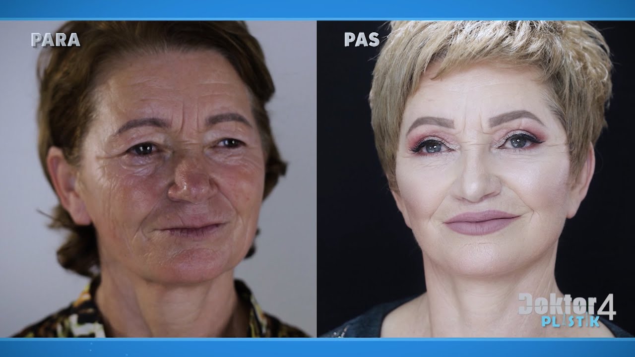 7 vjet pasi humbi të birin, kërkon ndryshim total fytyre në 