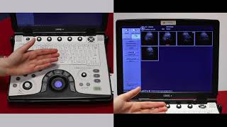 How to export images as JPEGS on the GE logiq e ultrasound scanner - video 9