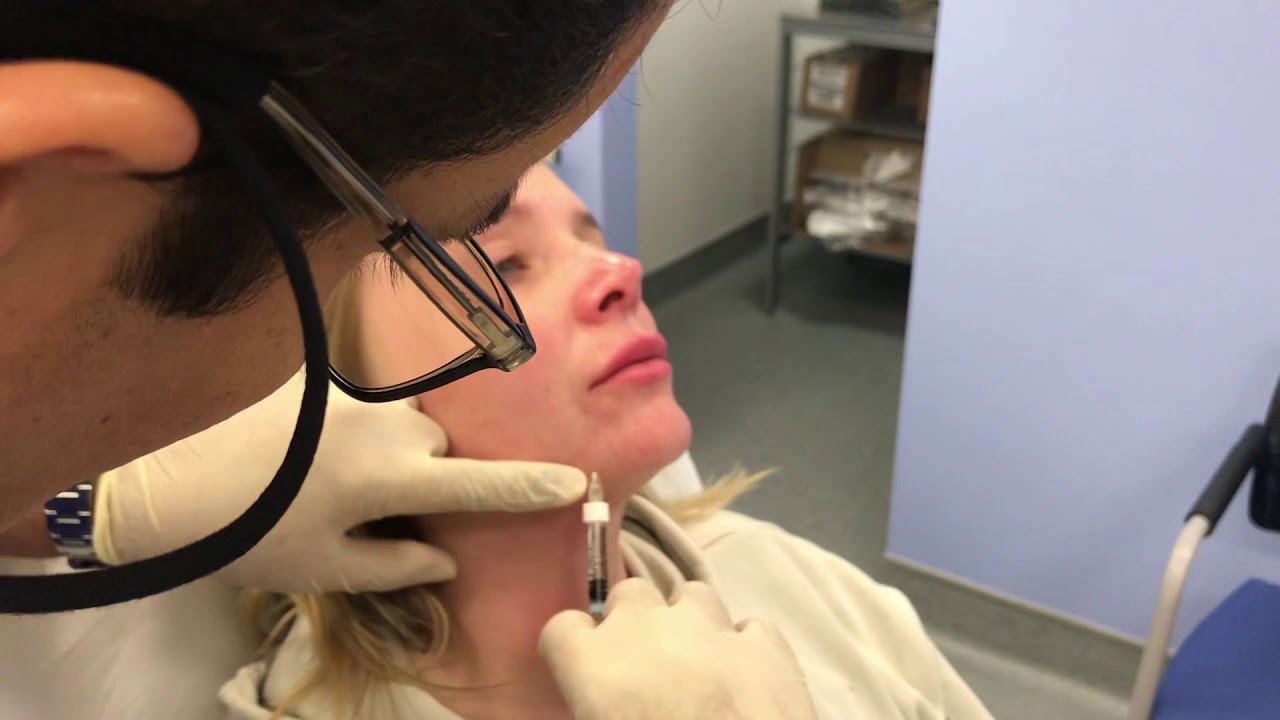 Acne Scars Filler YouTube