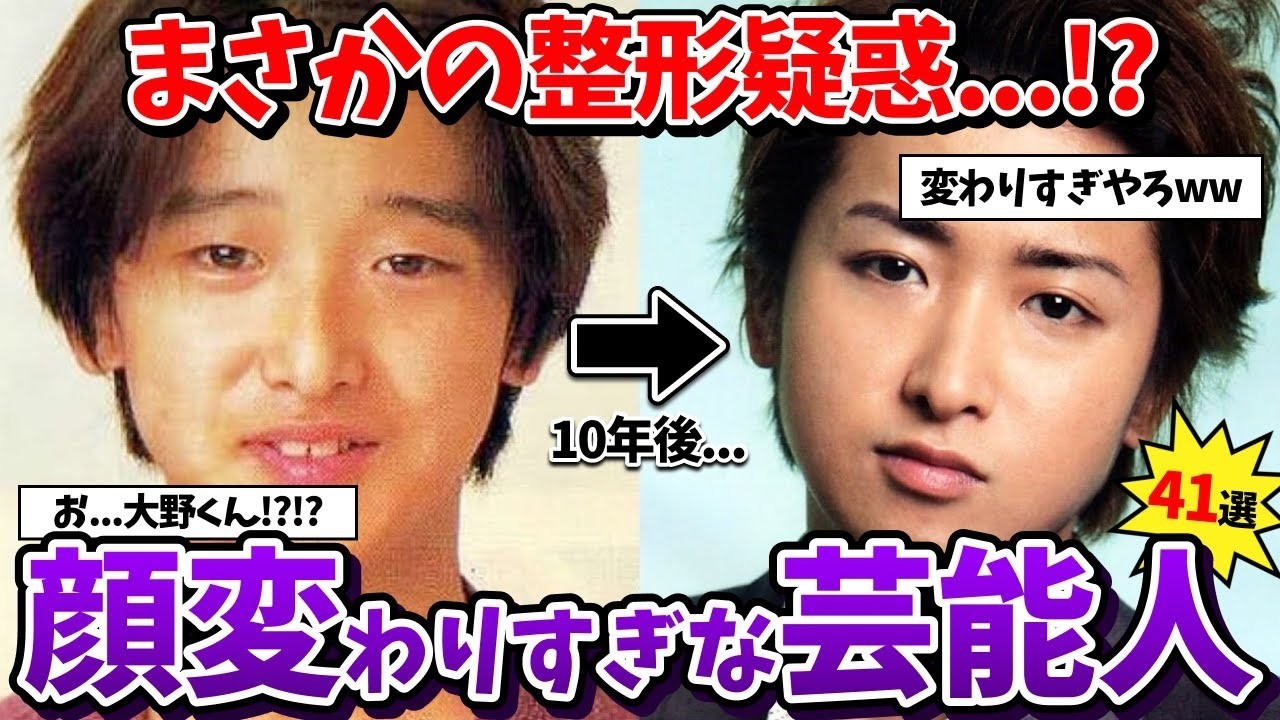 【有益2ch】昔と全然違うww正直整形だよね？と思う男性芸能人教えてww【ガールズちゃんねる】