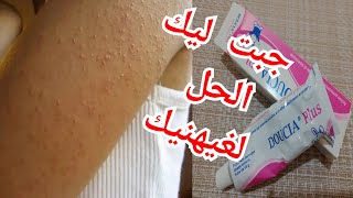 الحل النهائي لتهيج الجسم وظهور الحبوب بعد الحلاوة وغير ب 15 درهم