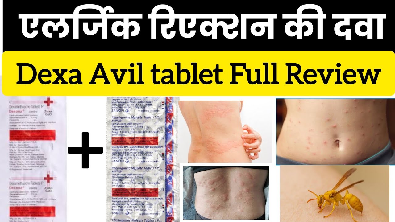 Dexa Avil Tablet Uses | Allergic Reactions सबसे अच्छी दवा 