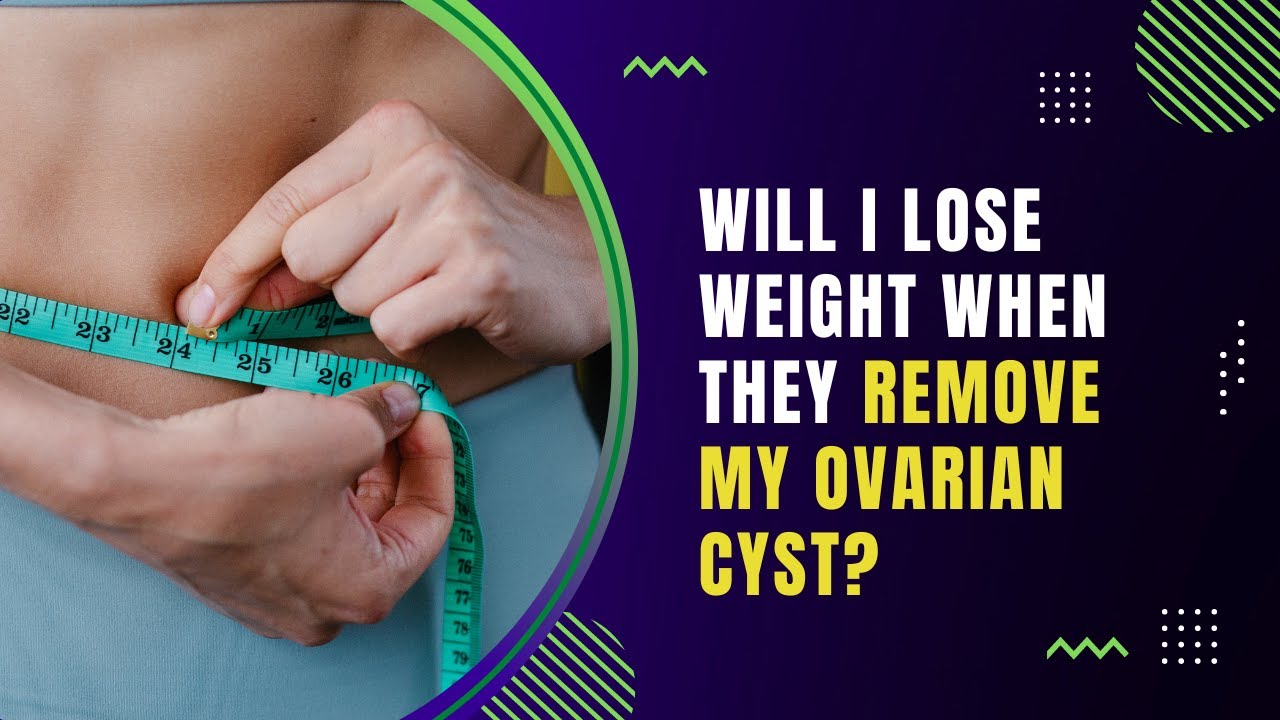 Will I lose weight when they remove my ovarian cyst? - YouTube