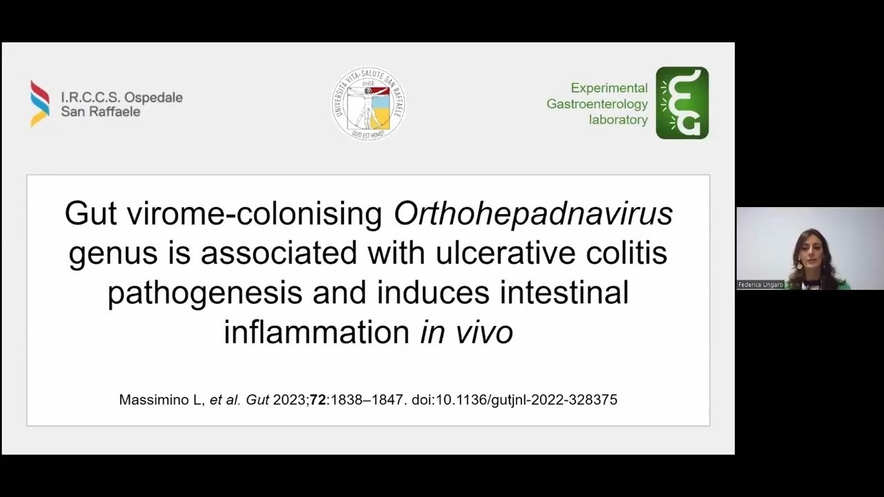 Gut virome is associated with ulcerative colitis pathogenesis