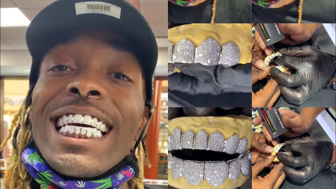VVS Diamonds white gold 8top 8bottom  GRILLZ Diamonds tested / to King daeshun / custom master mike
