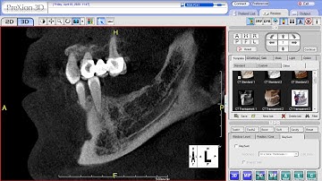 PreXion Training Tips: Pixel Density and Hounsfield Units