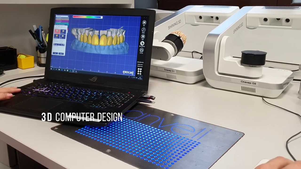 Most modern dental Lab for designed dental crown, veneers, bridges and ...