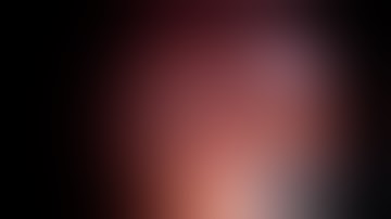 Laparoscopic liver biopsy in dog. Severe cirrhosis.