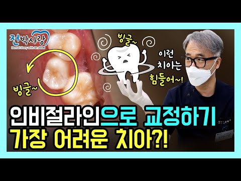 🌪인비절라인으로 가장 교정하기 힘들다는 '이것'‼‼🌪✅