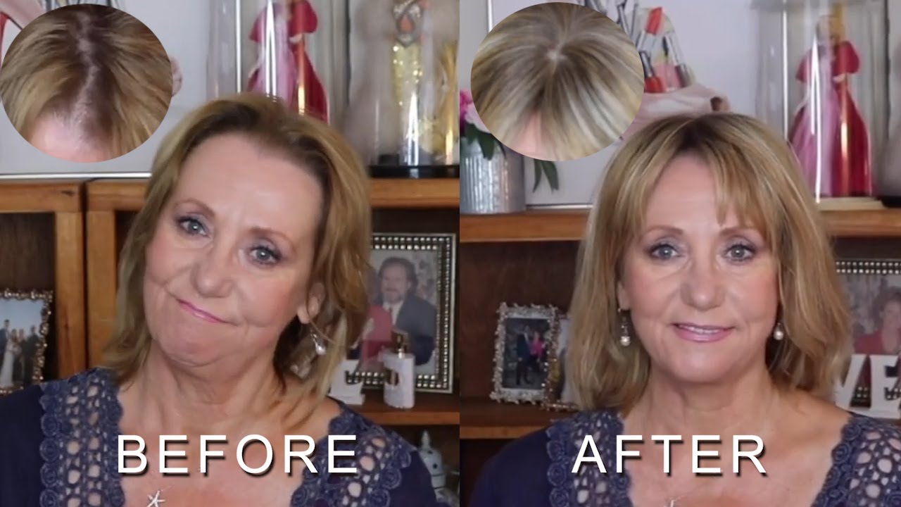 My First Hair Topper| A Super Secure & Natural Silk Top Topper