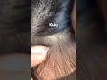liceinfestation746 #headliceremoval #licecomb #headlice #headlicetreatment #hairlice #haircare #hair