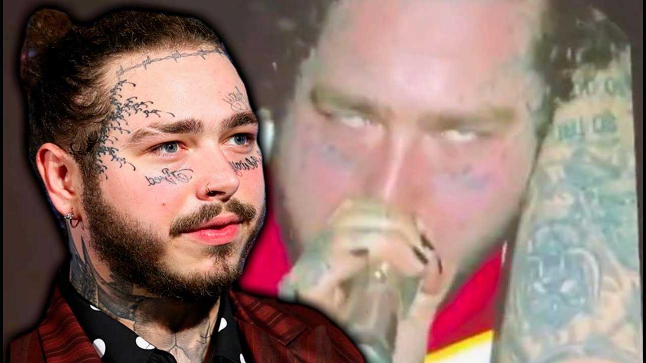 Post Malone Reacts to Fans Concerned About His Health (Is he okay ...