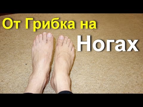 Обзор народных средств в борьбе с грибком рук