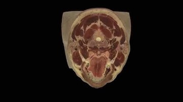 Visible Human Project: cross-section of a male head