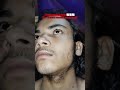 man matters minoxidil using day 210#viralshort #beardgrowth #minoxidil #keepsupporting