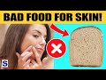 20 Foods that ruin your skin
