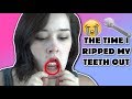 THE TIME I RIPPED MY TEETH OUT | Bethany Wilhelm