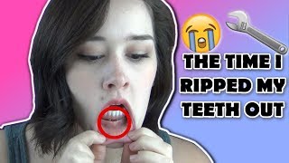 THE TIME I RIPPED MY TEETH OUT | Bethany Wilhelm