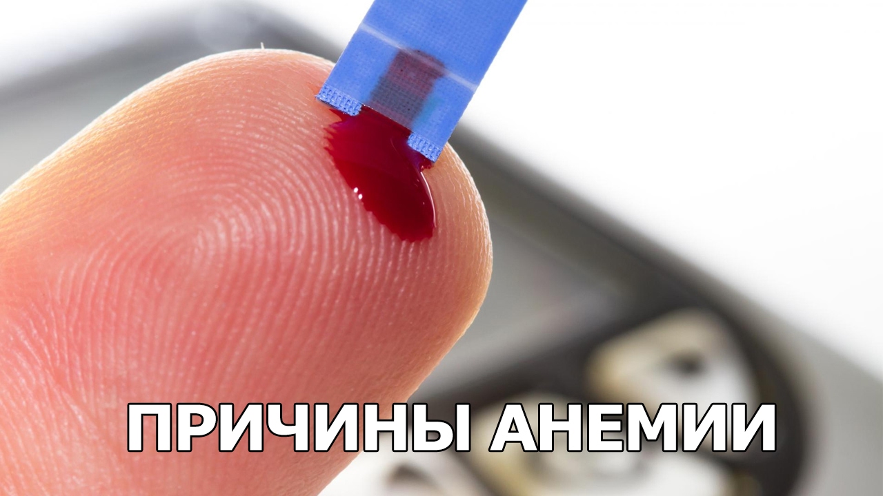 Причины анемии